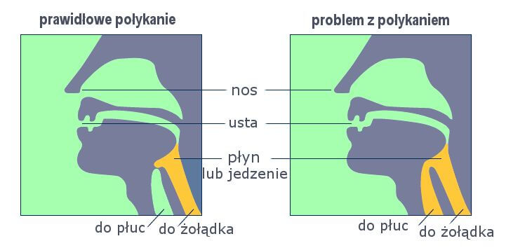 proces polykania